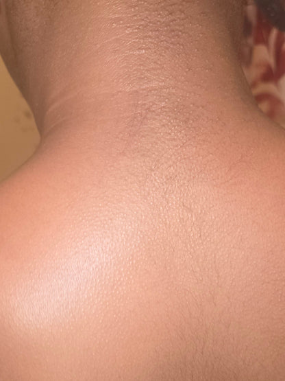 Eczema/ Acne Sensitive skin Body butter